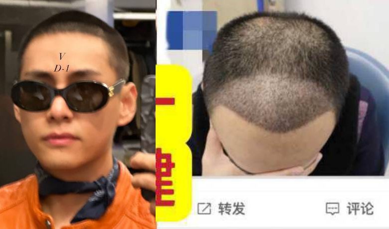 إتهام تايهيونغ بزراعة الشعر بعد حلاقة شعره وإنضمامه للجيش - آراكيبوب